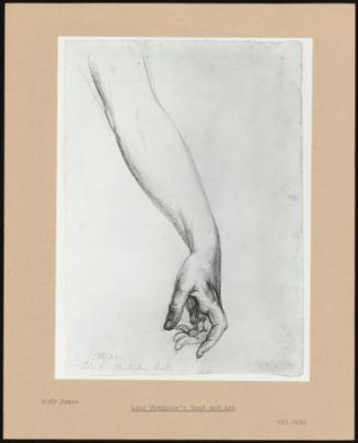 Lady Stanhope's Hand and Arm